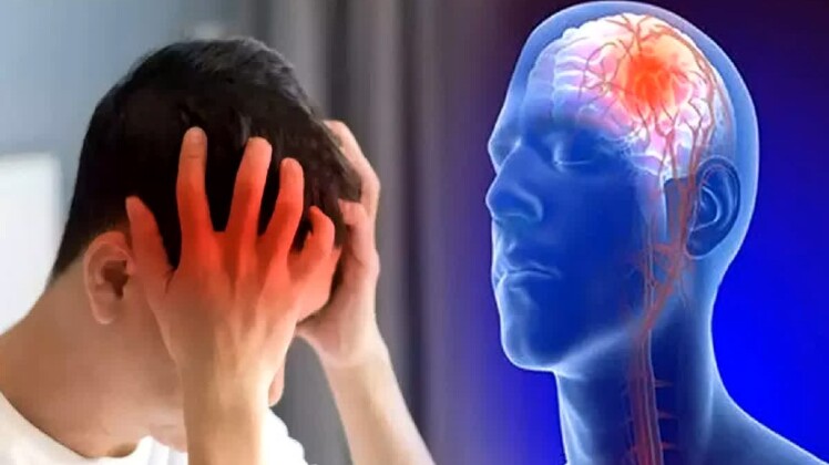 سکته مغزی (Stroke) چیست و چگونه اتفاق میافتد: علائم ، علت، درمان، توانبخشی و پیشگیری. درمان در منزل حرکت